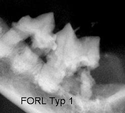FORL Typ1 Röntgenbild