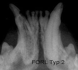 FORL Typ2 Röntgenbild