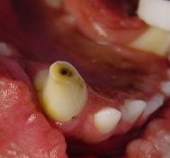 Hundegebiss mit abgebrochenen Zahn und abgestorbenem Nerv